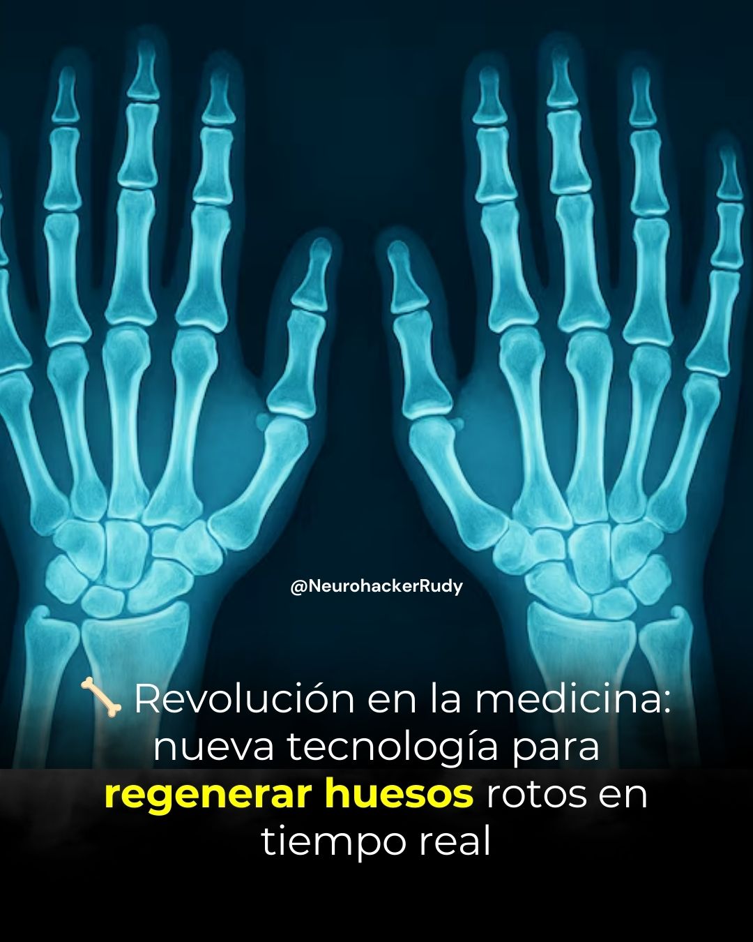 🦴 Revolución en la medicina: nueva tecnología para regenerar huesos rotos en tiempo real